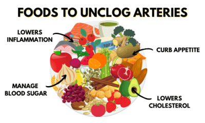 35 Foods To Unclog Arteries Infographic 400x240 