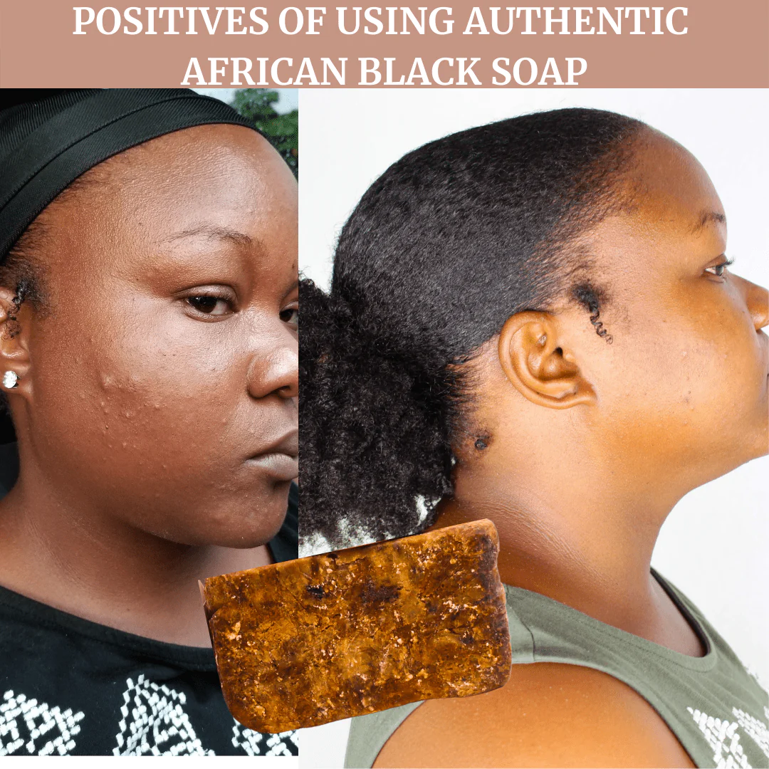 How To Use African Black Soap The Tech Edvocate